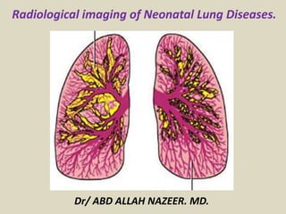 Radiological imaging of Neonatal Lung Diseases.
Dr/ ABD ALLAH NAZEER. MD.
 