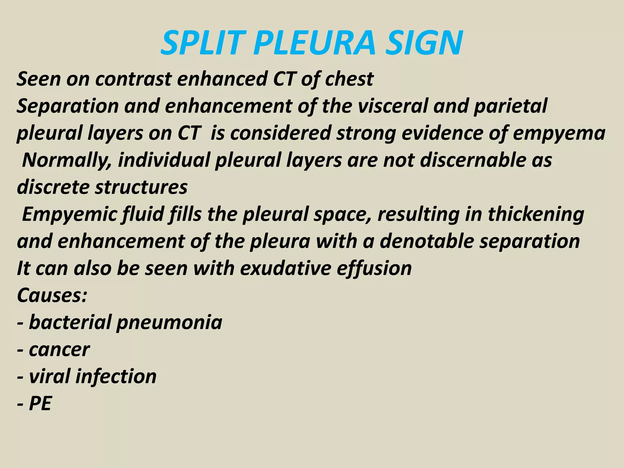 SPLIT PLEURA SIGN
Seen on contrast enhanced CT of chest
Separation and enhancement of the visceral and parietal
pleural layers on CT is considered strong evidence of empyema
Normally, individual pleural layers are not discernable as
discrete structures
Empyemic fluid fills the pleural space, resulting in thickening
and enhancement of the pleura with a denotable separation
It can also be seen with exudative effusion
Causes:
- bacterial pneumonia
- cancer
- viral infection
- PE
 