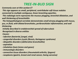 TREE-IN-BUD SIGN
Commonly seen at thin-section CT
This sign appears as small, peripheral, centrilobular soft tissue nodule...