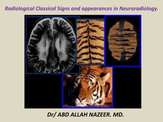 Radiological Classical Signs and appearances in Neuroradiology.
Dr/ ABD ALLAH NAZEER. MD.
 
