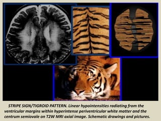 Presentation1.pptx, radiological classical signs and appearances in ...
