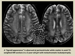Presentation1.pptx, radiological classical signs and appearances in ...