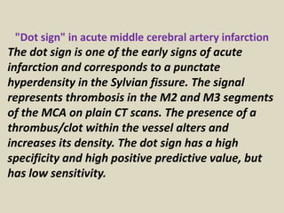 Punctate Infarction Presentation1.pptx, radiological classical signs and appearances in ...