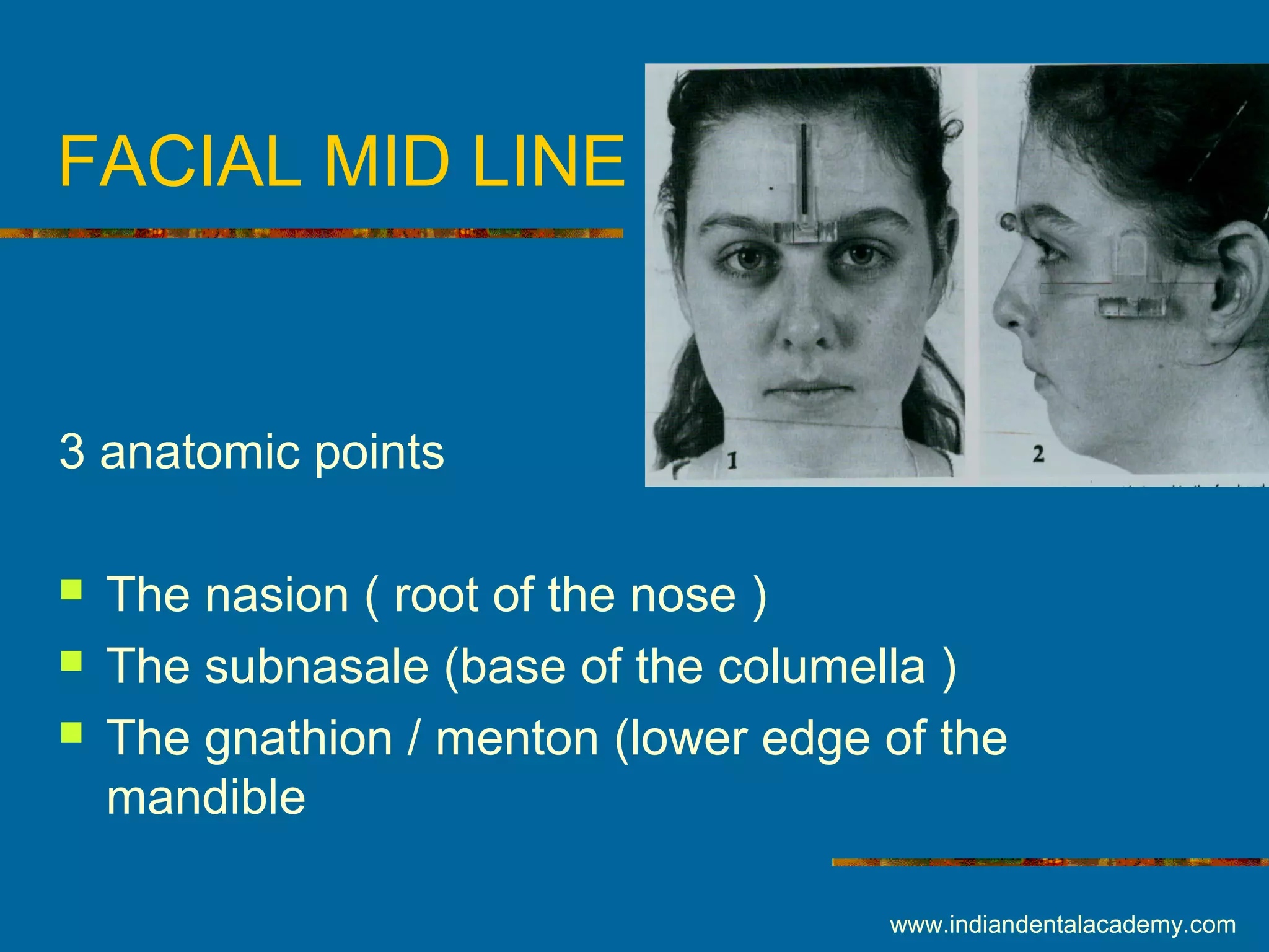FACIAL MID LINE
3 anatomic points
 The nasion ( root of the nose )
 The subnasale (base of the columella )
 The gnathion / menton (lower edge of the
mandible
www.indiandentalacademy.com
 