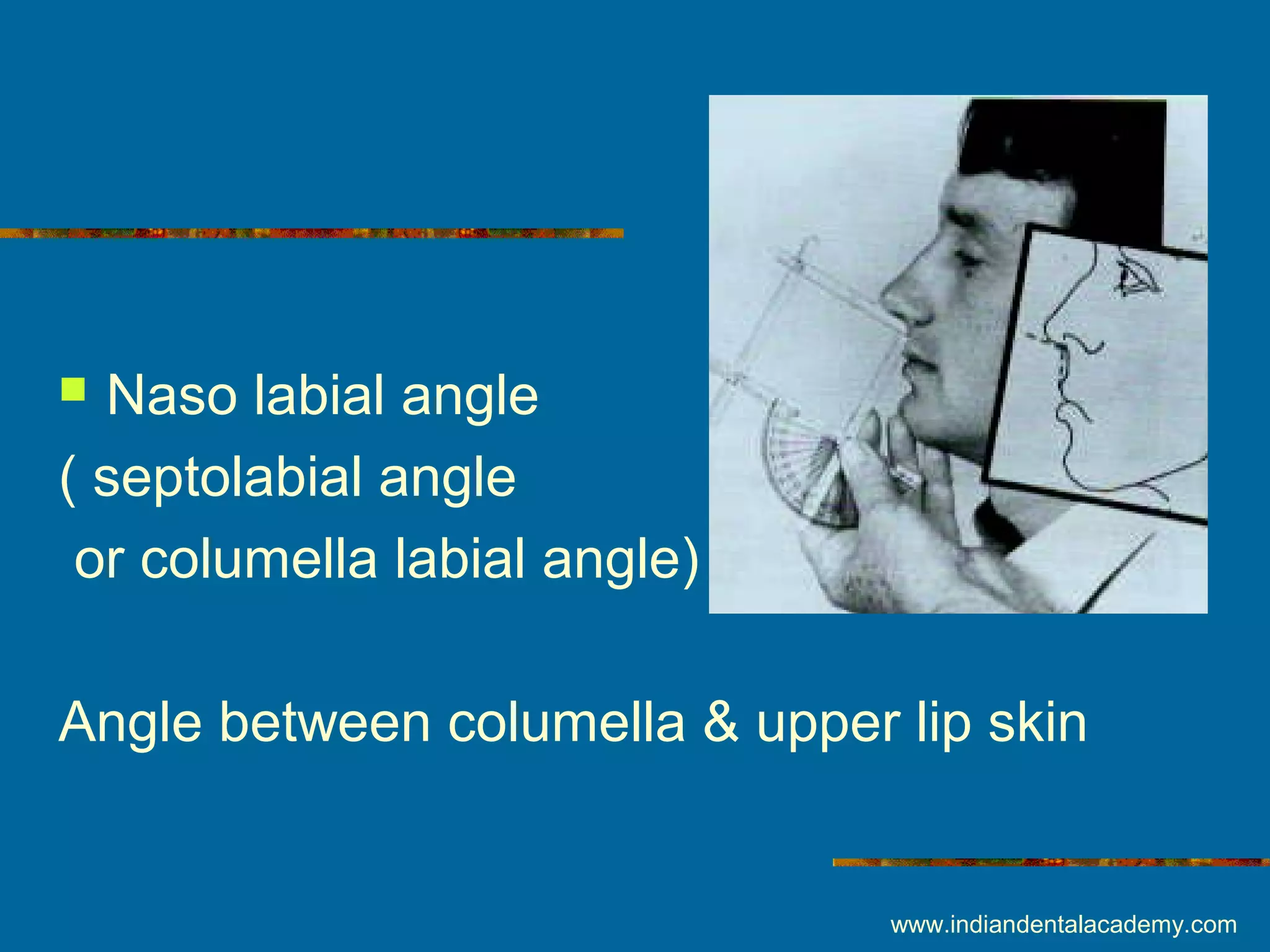  Naso labial angle
( septolabial angle
or columella labial angle)
Angle between columella & upper lip skin
www.indiandentalacademy.com
 