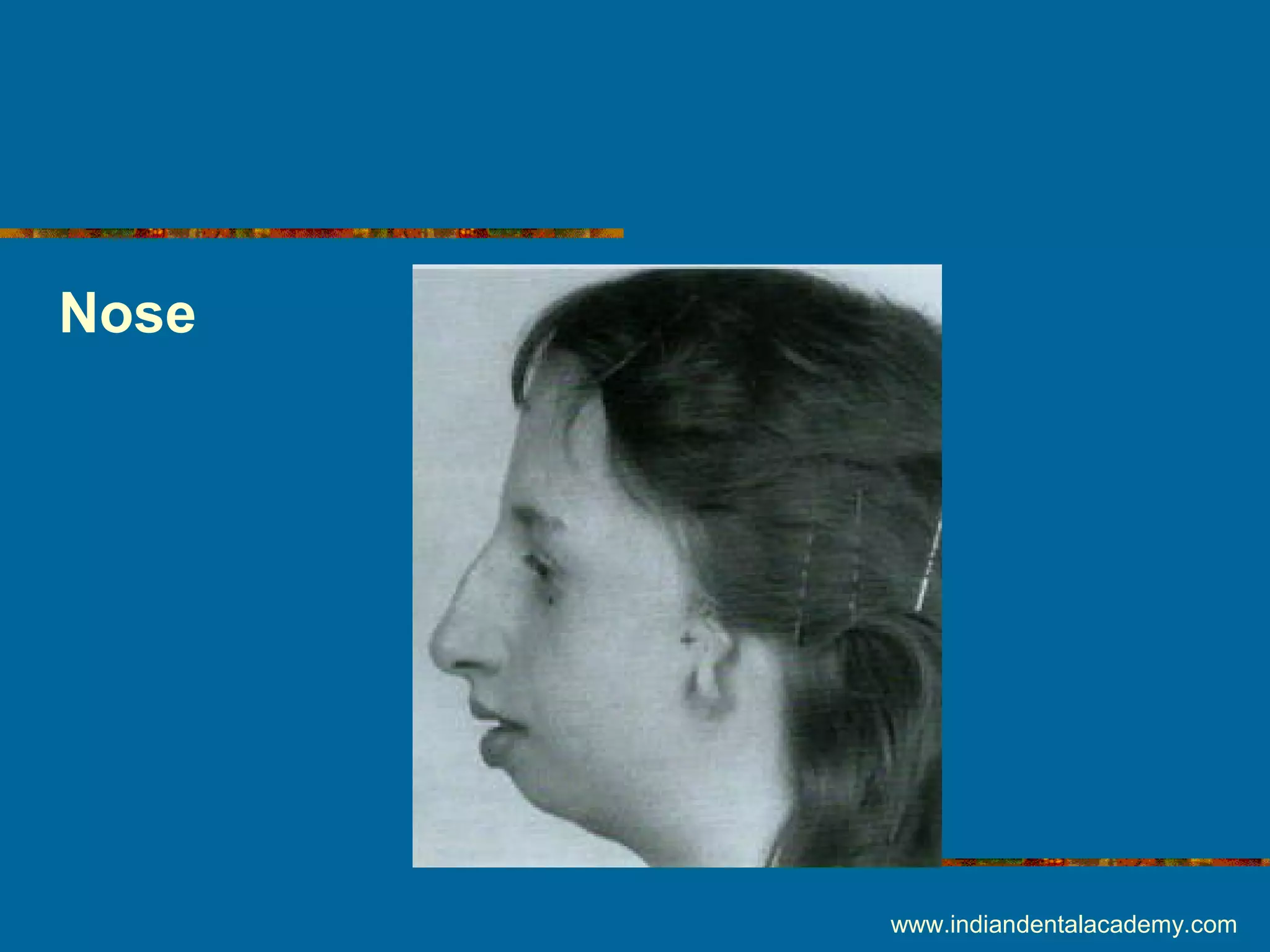 Nose
www.indiandentalacademy.com
 