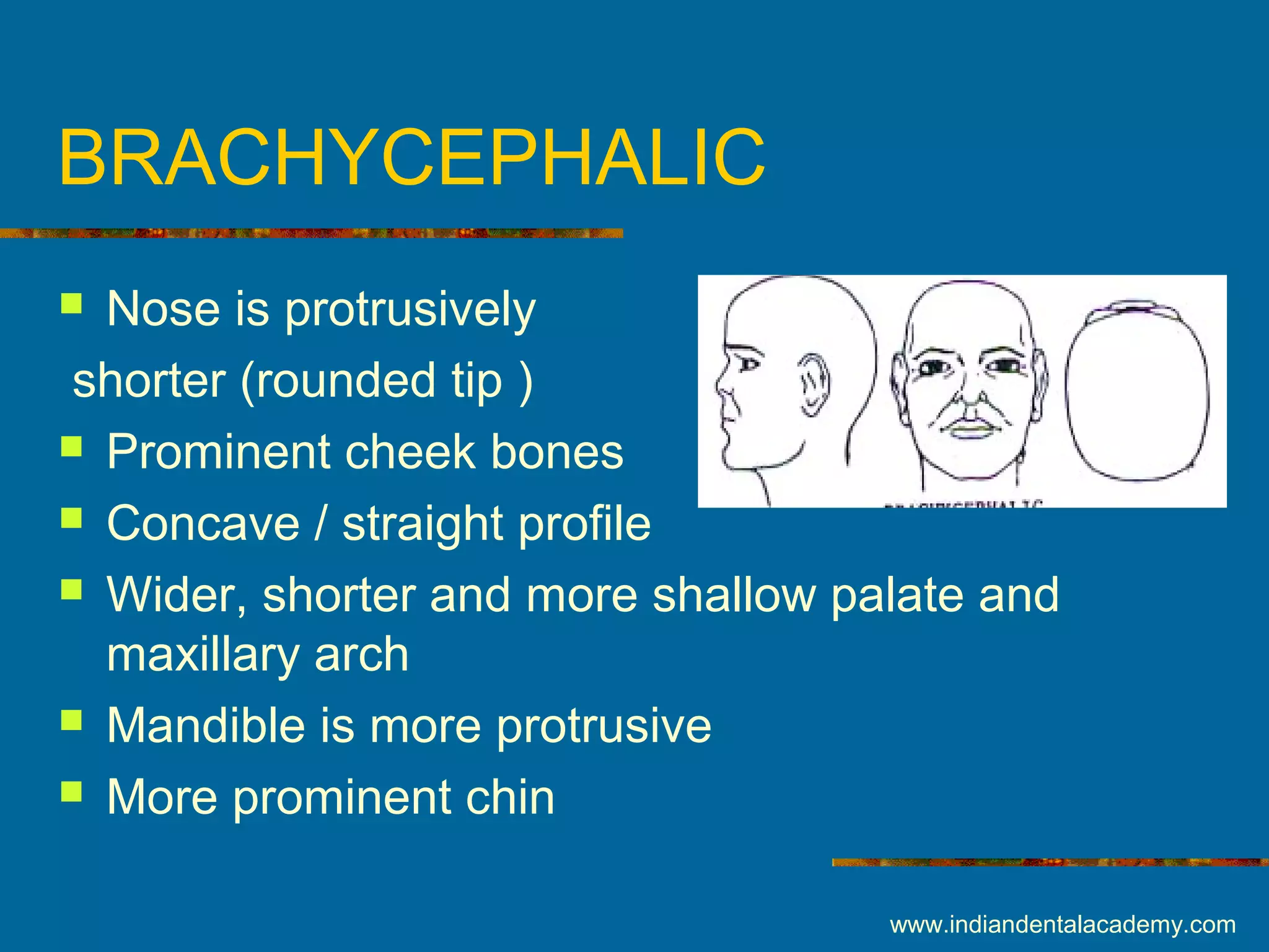 BRACHYCEPHALIC
 Nose is protrusively
shorter (rounded tip )
 Prominent cheek bones
 Concave / straight profile
 Wider, shorter and more shallow palate and
maxillary arch
 Mandible is more protrusive
 More prominent chin
www.indiandentalacademy.com
 