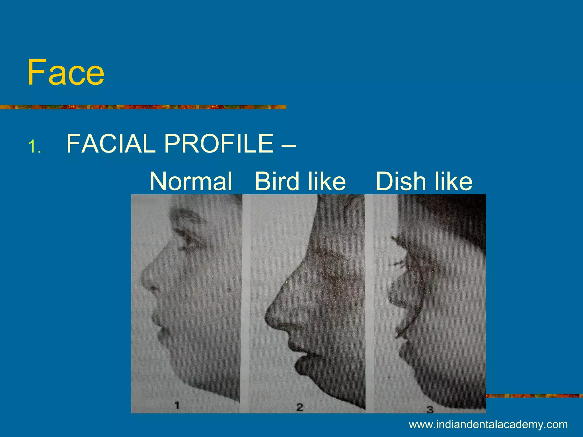 Face
1. FACIAL PROFILE –
Normal Bird like Dish like
www.indiandentalacademy.com
 