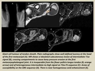 Presentation1 pptx Radiological Imaging Of Soft Tissue Masses Of The Presentation1 pptx Radiological Imaging Of Soft Tissue Masses Of The