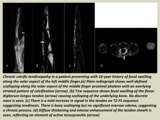 Presentation1.pptx, radiological imaging of soft tissue masses of the ...