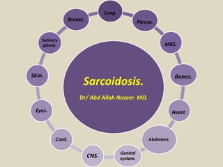 Sarcoidosis.
Dr/ Abd Allah Nazeer. MD.
Lung.
Pleura.
MKS.
Bones.
Heart.
Abdomen.
Genital
system.CNS.
Cord.
Eyes.
Skin.
Salivary
glands.
Breast.
 