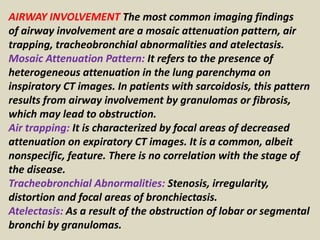 AIRWAY INVOLVEMENT The most common imaging findings
of airway involvement are a mosaic attenuation pattern, air
trapping, tracheobronchial abnormalities and atelectasis.
Mosaic Attenuation Pattern: It refers to the presence of
heterogeneous attenuation in the lung parenchyma on
inspiratory CT images. In patients with sarcoidosis, this pattern
results from airway involvement by granulomas or fibrosis,
which may lead to obstruction.
Air trapping: It is characterized by focal areas of decreased
attenuation on expiratory CT images. It is a common, albeit
nonspecific, feature. There is no correlation with the stage of
the disease.
Tracheobronchial Abnormalities: Stenosis, irregularity,
distortion and focal areas of bronchiectasis.
Atelectasis: As a result of the obstruction of lobar or segmental
bronchi by granulomas.
 