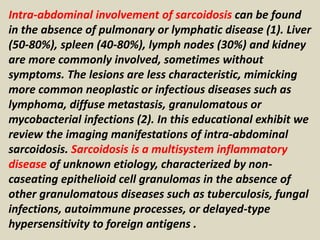 Intra-abdominal involvement of sarcoidosis can be found
in the absence of pulmonary or lymphatic disease (1). Liver
(50-80%), spleen (40-80%), lymph nodes (30%) and kidney
are more commonly involved, sometimes without
symptoms. The lesions are less characteristic, mimicking
more common neoplastic or infectious diseases such as
lymphoma, diffuse metastasis, granulomatous or
mycobacterial infections (2). In this educational exhibit we
review the imaging manifestations of intra-abdominal
sarcoidosis. Sarcoidosis is a multisystem inflammatory
disease of unknown etiology, characterized by non-
caseating epithelioid cell granulomas in the absence of
other granulomatous diseases such as tuberculosis, fungal
infections, autoimmune processes, or delayed-type
hypersensitivity to foreign antigens .
 
