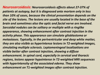 Neurosarcoidosis: Neurosarcoidosis affects about 27-37% of
patients at autopsy, but it is diagnosed ante mortem only in less
than 10% of cases, because the clinical presentation depends on the
site of the lesions. The lesions are usually located in the base of the
brain and sometimes also the optic and facial nerve are involved.
Sarcoidal nodules can be solitary or multiple with a ringlike
appearance, showing enhancement after contrast injection in the
activity phase. This appearance can simulate glioblastoma or
metastases. Typically, in the periventricular and deep white matter,
they are also visible as hyperintense lesions in T2-weighted images,
simulating multiple sclerosis. Leptomeningeal localizations are
visible better after contrast injection, showing a diffuse
enhancement. In spinal cord, especially in cervical and thoracic
regions, lesions appear hypointense in T2-weighted MRI sequences
with hyperintensity of the associated edema. They show
enhancement on T1-weighted images after contrast injection.
 
