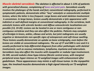 Muscle-skeletal sarcoidosis The skeleton is affected in about 1-13% of patients
with generalized disease, complaining of bone and joint pain. Sarcoidosis usually
involves the phalanges of the hands and feet; conventional radiography, performed in
symptomatic patients, demonstrate either "lacy" osteolytic or osteosclerotic multiple
lesions, where the latter is less frequent. Large bones and axial skeleton involvement
is uncommon. In large bones, lesions usually demonstrate a lytic appearance with
indistinct or well-defined margins at conventional radiography. In the vertebrae, both
osteolytic lesions with sclerotic borders and diffuse osteosclerotic localizations are
possible [13, 19-20]. Lesions can be located in one or more contiguous or non-
contiguous vertebrae and they can also affect the pedicles. Patients may complain
of arthralgia in knees, ankles, elbows and wrists, but joint radiograms are usually
negative or demonstrate non-specific signs of osteoporosis and soft-tissue swelling.
These lesions usually demonstrate an uptake on bone scintigraphy, even before the
lesions are visible at conventional radiograms. The use of CT and MRI is rare and it is
usually performed to help differential diagnosis from other pathologies with skeletal
involvement, such as osseous metastases, lymphoma, myeloma and tuberculosis.
Sarcoidosis may also affect the muscles with myopathic or nodular type involvement.
On MR, sarcoid nodules show hypo-intense fibrotic central areas, with marginal
peripheral areas hyper-intense on T2-weighted images with enhancement after
gadolinium. These appearances may mimic a soft-tissue tumor. In the myopathic
type, the involved muscles demonstrate a high signal intensity on T2-weighted
images.
 