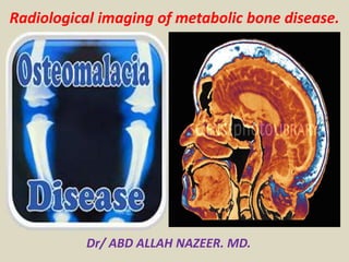 Radiological imaging of metabolic bone disease.
Dr/ ABD ALLAH NAZEER. MD.
 