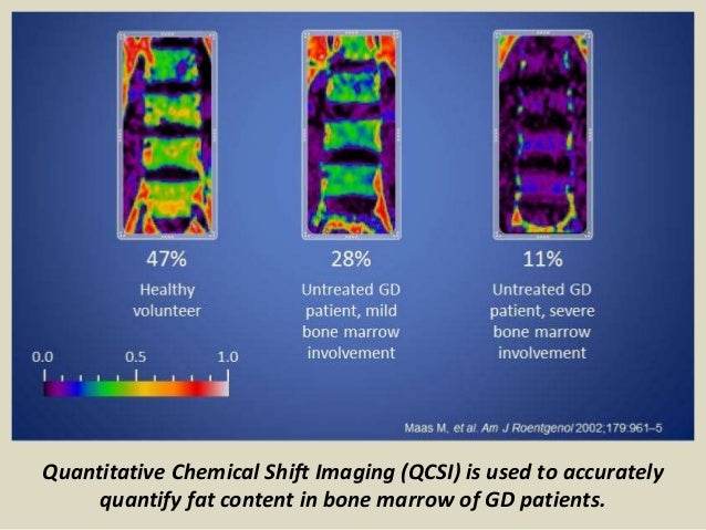 Presentation1 pptx Radiological Imaging Of Metabolic Bone Diseases 