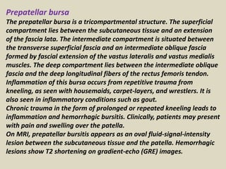 Prepatellar bursa
The prepatellar bursa is a tricompartmental structure. The superficial
compartment lies between the subcutaneous tissue and an extension
of the fascia lata. The intermediate compartment is situated between
the transverse superficial fascia and an intermediate oblique fascia
formed by fascial extension of the vastus lateralis and vastus medialis
muscles. The deep compartment lies between the intermediate oblique
fascia and the deep longitudinal fibers of the rectus femoris tendon.
Inflammation of this bursa occurs from repetitive trauma from
kneeling, as seen with housemaids, carpet-layers, and wrestlers. It is
also seen in inflammatory conditions such as gout.
Chronic trauma in the form of prolonged or repeated kneeling leads to
inflammation and hemorrhagic bursitis. Clinically, patients may present
with pain and swelling over the patella.
On MRI, prepatellar bursitis appears as an oval fluid-signal-intensity
lesion between the subcutaneous tissue and the patella. Hemorrhagic
lesions show T2 shortening on gradient-echo (GRE) images.
 