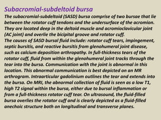 Subacromial-subdeltoid bursa
The subacromial-subdeltoid (SASD) bursa comprise of two bursae that lie
between the rotator cuff tendons and the undersurface of the acromion.
They are located deep in the deltoid muscle and acromioclavicular joint
(AC joint) and overlie the bicipital groove and rotator cuff.
The causes of SASD bursal fluid include: rotator cuff tears, impingement,
septic bursitis, and reactive bursitis from glenohumeral joint disease,
such as calcium deposition arthropathy. In full-thickness tears of the
rotator cuff, fluid from within the glenohumeral joint tracks through the
tear into the bursa. Communication with the joint is abnormal in this
location. This abnormal communication is best depicted on an MR
arthrogram. Intraarticular gadolinium outlines the tear and extends into
the bursa. On MRI, the abnormal collection of fluid is seen as a low T1,
high T2 signal within the bursa, either due to bursal inflammation or
from a full-thickness rotator cuff tear. On ultrasound, the fluid-filled
bursa overlies the rotator cuff and is clearly depicted as a fluid-filled
anechoic structure both on longitudinal and transverse planes.
 