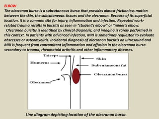 ELBOW
The olecranon bursa is a subcutaneous bursa that provides almost frictionless motion
between the skin, the subcutaneous tissues and the olecranon. Because of its superficial
location, it is a common site for injury, inflammation and infection. Repeated work-
related trauma results in bursitis as seen in “student's elbow” or “miner's elbow.
Olecranon bursitis is identified by clinical diagnosis, and imaging is rarely performed in
this context. In patients with advanced infection, MRI is sometimes requested to evaluate
abscesses or osteomyelitis. Incidental diagnosis of olecranon bursitis on ultrasound and
MRI is frequent from concomitant inflammation and effusion in the olecranon bursa
secondary to trauma, rheumatoid arthritis and other inflammatory diseases.
Line diagram depicting location of the olecranon bursa.
 