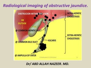 Radiological imaging of obstructive jaundice.
Dr/ ABD ALLAH NAZEER. MD.
 