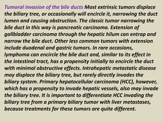 Tumoral invasion of the bile ducts Most extrinsic tumors displace
the biliary tree, or occasionally will encircle it, narrowing the duct
lumen and causing obstruction. The classic tumor narrowing the
bile duct in this way is pancreatic carcinoma. Extension of
gallbladder carcinoma through the hepatic hilum can entrap and
narrow the bile duct. Other less common tumors with extension
include duodenal and gastric tumors. In rare occasions,
lymphoma can encircle the bile duct and, similar to its effect in
the intestinal tract, has a propensity initially to encircle the duct
with minimal obstructive effects. Intrahepatic metastatic disease
may displace the biliary tree, but rarely directly invades the
biliary system. Primary hepatocellular carcinoma (HCC), however,
which has a propensity to invade hepatic vessels, also may invade
the biliary tree. It is important to differentiate HCC invading the
biliary tree from a primary biliary tumor with liver metastases,
because treatments for these tumors are quite different.
 