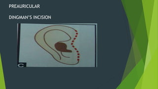 Presentation temporomandibular joint anatomy | PPTX