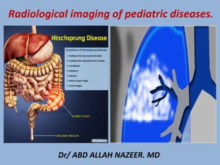 Radiological imaging of pediatric diseases.
Dr/ ABD ALLAH NAZEER. MD.
 