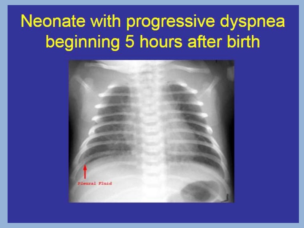 Presentation1.pptx, pediatric radiology.