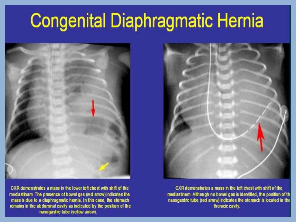 Presentation1.pptx, pediatric radiology.