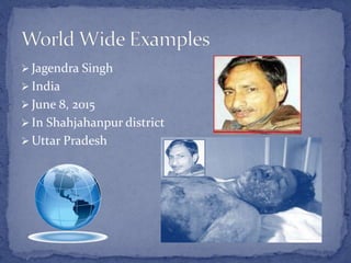  Jagendra Singh
 India
 June 8, 2015
 In Shahjahanpur district
 Uttar Pradesh
 