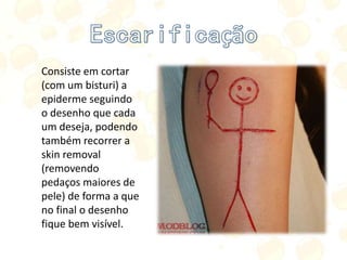 Consiste em cortar
(com um bisturi) a
epiderme seguindo
o desenho que cada
um deseja, podendo
também recorrer a
skin removal
(removendo
pedaços maiores de
pele) de forma a que
no final o desenho
fique bem visível.
 