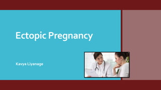 Ectopic Pregnancy
Kavya Liyanage
 