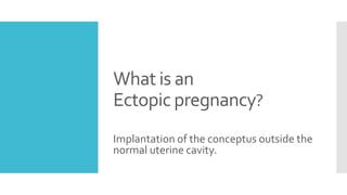 What is an
Ectopic pregnancy?
Implantation of the conceptus outside the
normal uterine cavity.
 