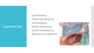 Laparoscopy
 Less blood loss
 Shorter operating time
 Less anaelgesia
 Shorter hospital stay
 Shorter convalescence
 Mainstay of management
 