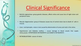 Clinical Significance
• Retinitis pigmentosa- group genetic diseases, affects retina and cause loss of night vision and
peripheral vision.
• Macular degeneration- group of diseases causes loss of central vision due to death of cells in
macula.
• Cone –rod dystrophy –vision is lost caused by deterioration of cones and rods in the retina.
• Hypertension and Diabetes mellitus – causes damage to blood vessels that supply
retina,causes HYPERTENSIVE RETINOPATHY and DIABETIC RETINOPATHY .
• RETINOBLASTOMA –cancer of retina
 