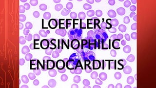 LOEFFLER’S
EOSINOPHILIC
ENDOCARDITIS
 