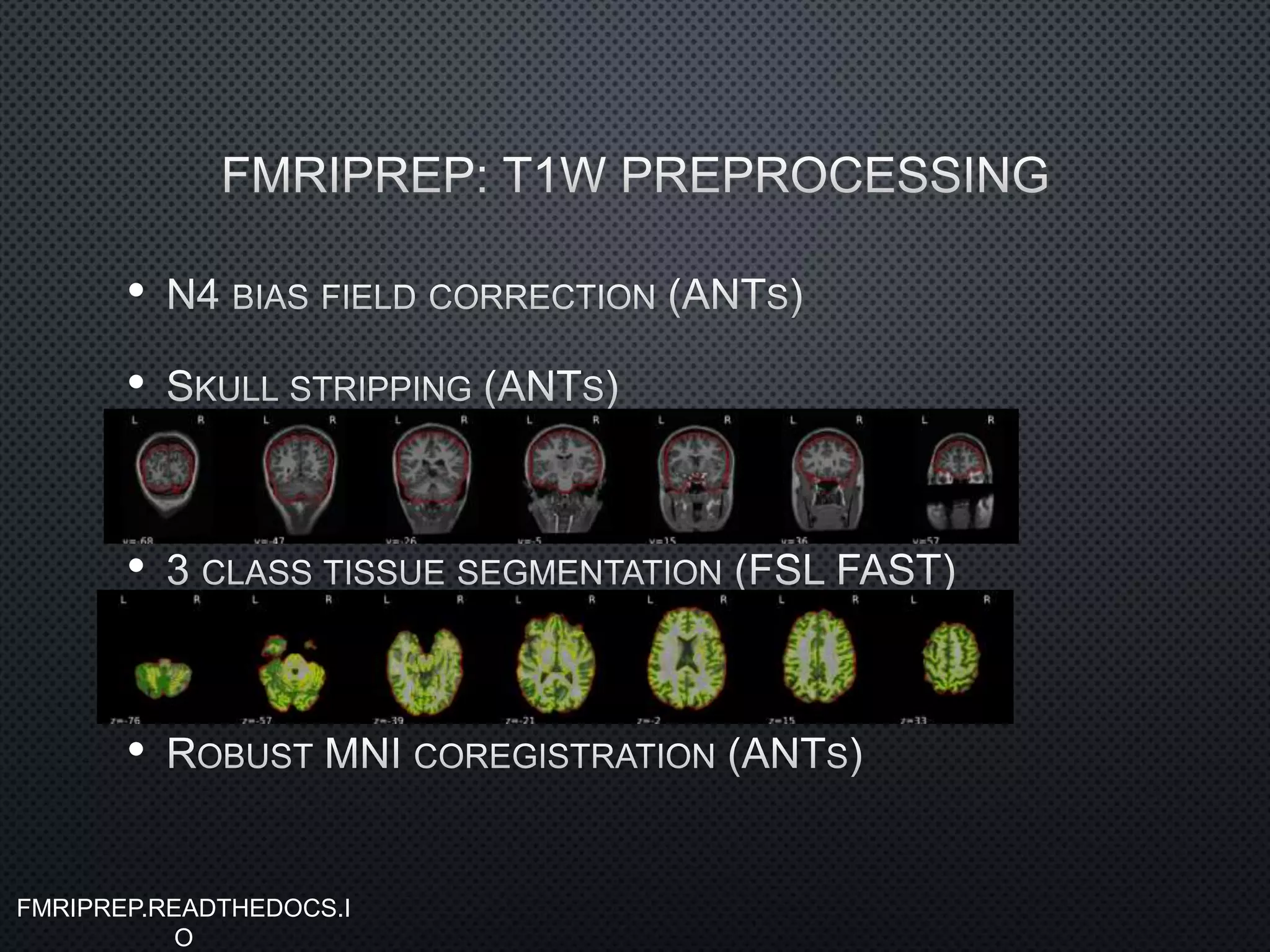 •
•
•
•
FMRIPREP.READTHEDOCS.I
O
 