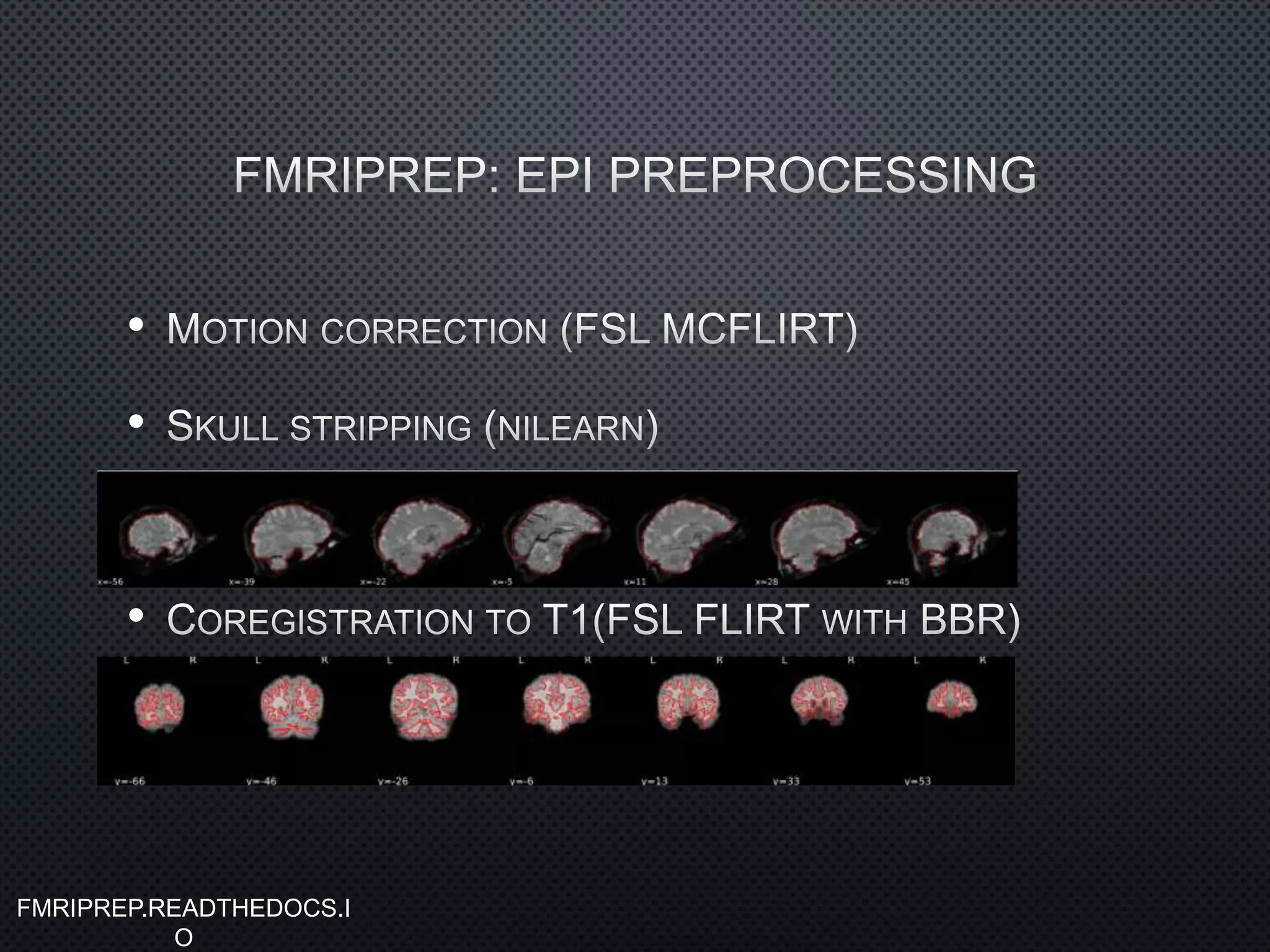 •
•
•
FMRIPREP.READTHEDOCS.I
O
 