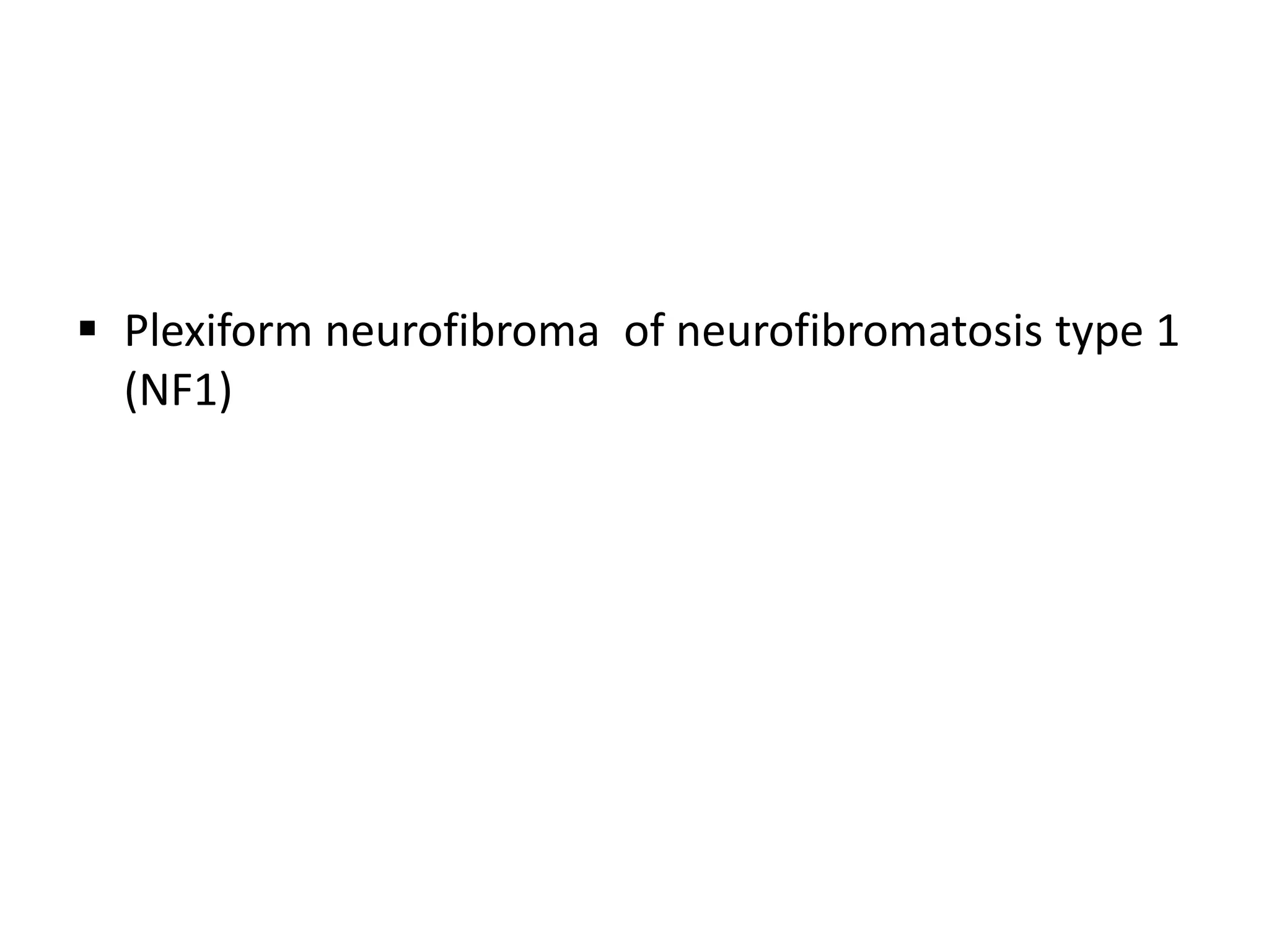  Plexiform neurofibroma of neurofibromatosis type 1
(NF1)
 