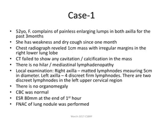 Case-1
• 52yo, F. complains of painless enlarging lumps in both axilla for the
past 3months
• She has weakness and dry cough since one month
• Chest radiograph reveled 1cm mass with irregular margins in the
right lower lung lobe
• CT failed to show any cavitation / calcification in the mass
• There is no hilar / mediastinal lymphadenopathy
• Local examination: Right axilla – matted lymphnodes meauring 5cm
in diameter. Left axilla – 4 discreet firm lymphnodes. There are two
discreet lymphnodes in the left upper cervical region
• There is no organomegaly
• CBC was normal
• ESR 80mm at the end of 1st hour
• FNAC of lung nodule was performed
March-2017-CSBRP
 