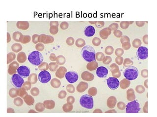 Peripheral Blood smear
March-2017-CSBRP
 