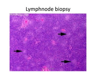 Lymphnode biopsy
March-2017-CSBRP
 