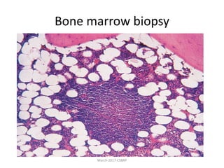 Bone marrow biopsy
March-2017-CSBRP
 
