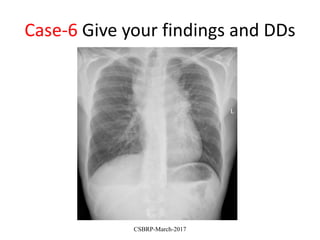 Case-6 Give your findings and DDs
CSBRP-March-2017
 