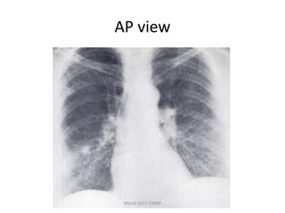 AP view
March-2017-CSBRP
 