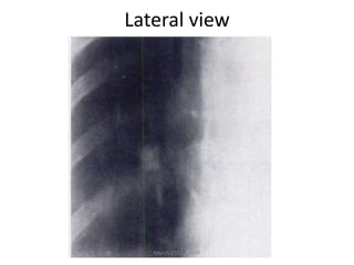 Lateral view
March-2017-CSBRP
 