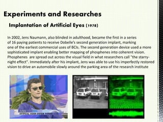 Experiments and Researches
In 2002, Jens Naumann, also blinded in adulthood, became the first in a series
of 16 paying patients to receive Dobelle’s second generation implant, marking
one of the earliest commercial uses of BCIs. The second generation device used a more
sophisticated implant enabling better mapping of phosphenes into coherent vision.
Phosphenes are spread out across the visual field in what researchers call "the starry-
night effect". Immediately after his implant, Jens was able to use his imperfectly restored
vision to drive an automobile slowly around the parking area of the research institute
Implantation of Artificial Eyes (1978)
 