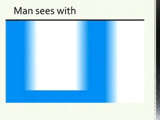 Man sees with
'bionic eye'
 