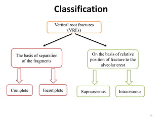 Classification
The basis of separation
of the fragments
Complete
On the basis of relative
position of fracture to the
alveolar crest
Incomplete Supraosseous Intraosseous
Vertical root fractures
(VRFs)
10
 